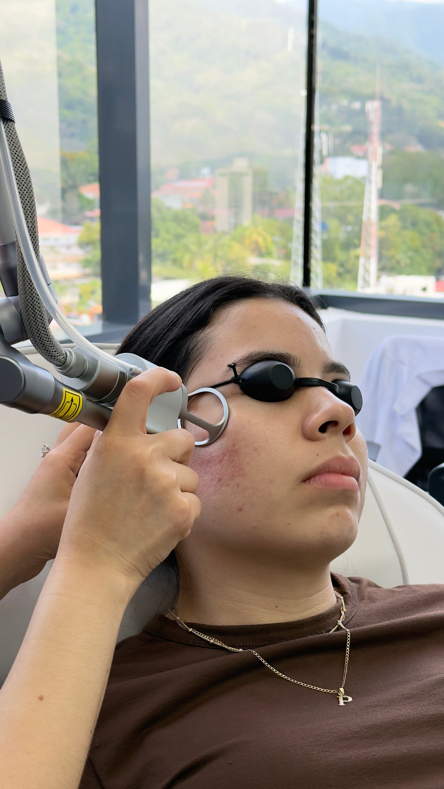 Rejuvenecimiento Facial