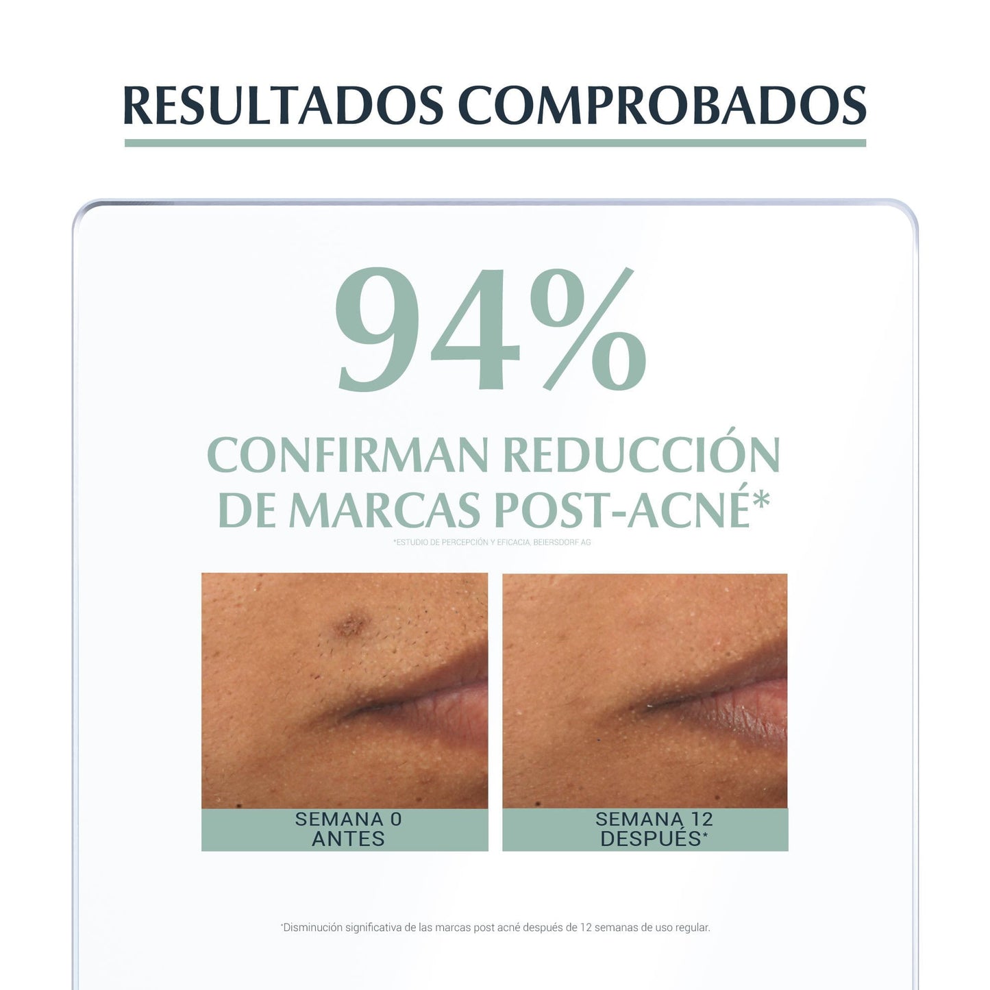 Dermopure Triple Effect Serum Eucerin 40 ml EXP 05/27