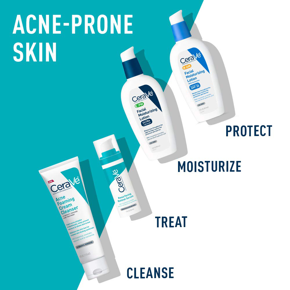 Acne-Prone Skin Kit by CeraVe