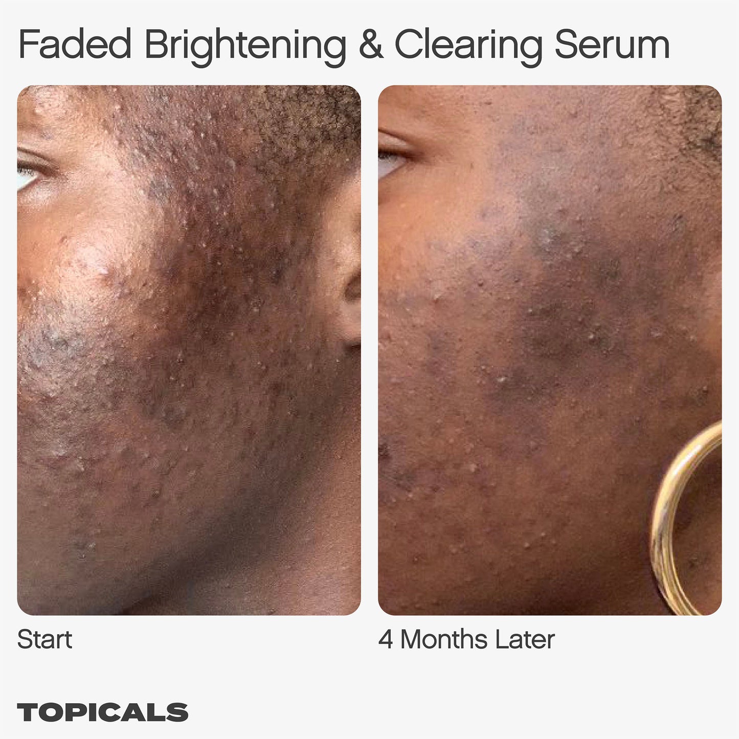 Faded Serum for Dark Spots & Discoloration Topicals 15 ml