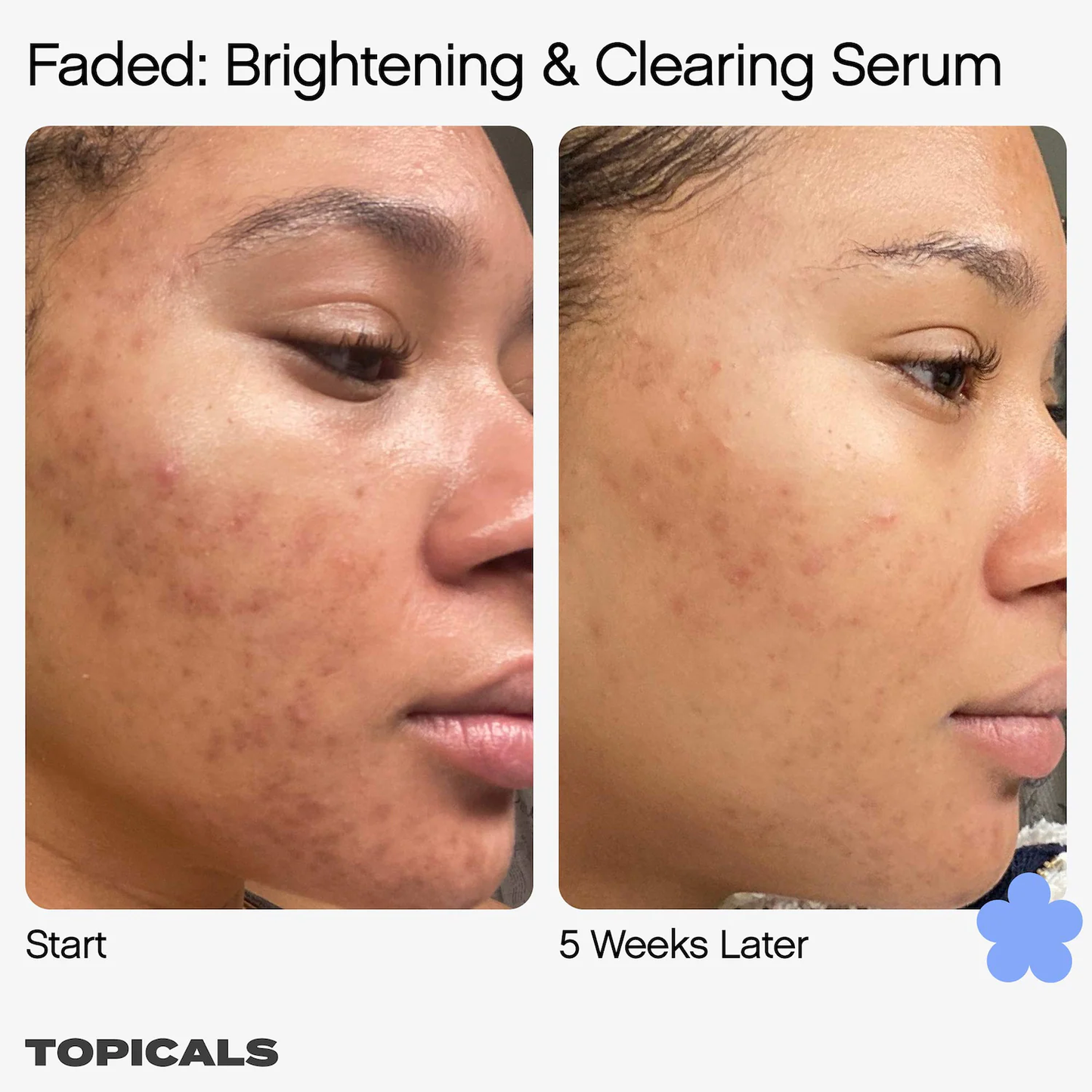 Faded Serum for Dark Spots & Discoloration Topicals 15 ml